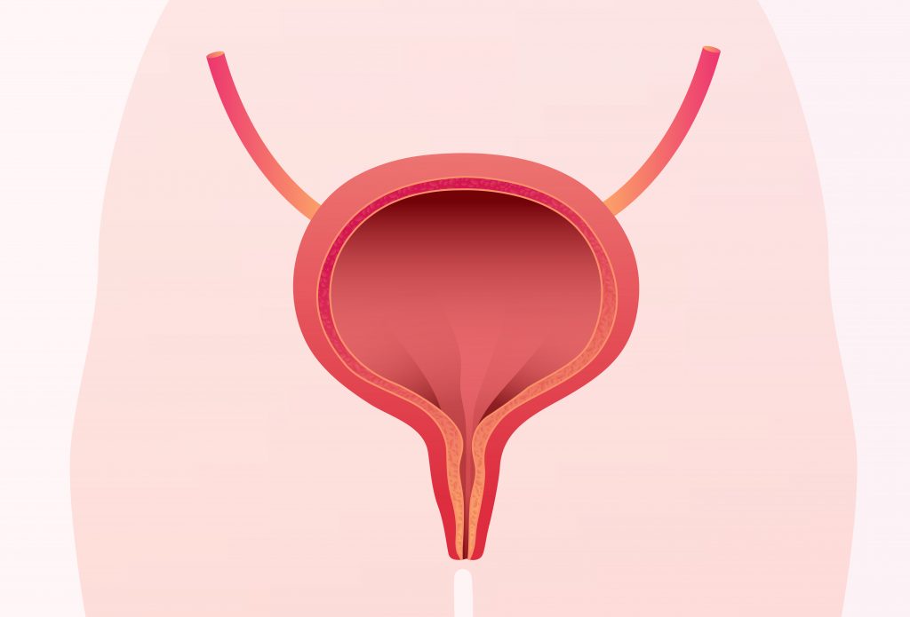 Clínica Urologia Goiânia - Câncer de bexiga é o segundo tipo de câncer mais frequente do trato urinário