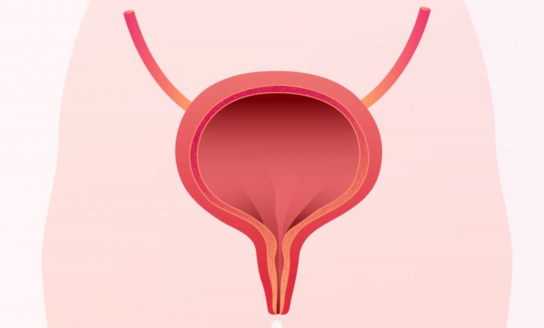 Clínica Urologia Goiânia - Câncer de bexiga é o segundo tipo de câncer mais frequente do trato urinário