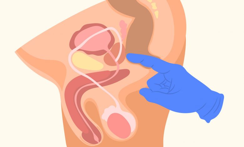 Urologista Goiânia - Rastreio do câncer de próstata quais exames são realizados