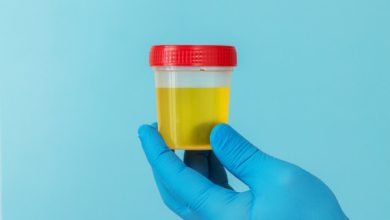 Sabia que o sangue na urina está presente em 90% dos casos de câncer de bexiga